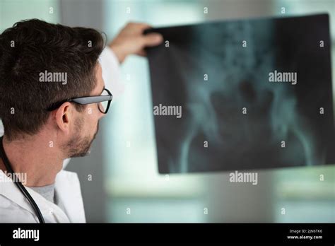 Radiographie pulmonaire Banque de photographies et dimages à haute
