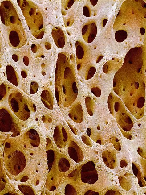 Bone Tissue Stock Image P1050176 Science Photo Library