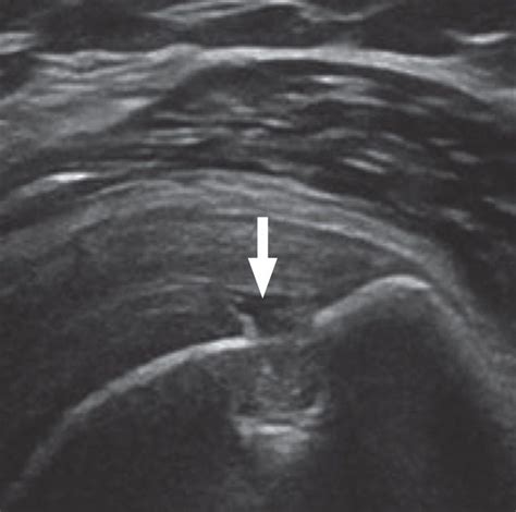 Musculoskeletal Ultrasound Ashmore Osteopathic Groupashmore
