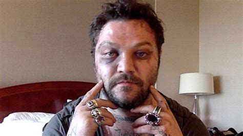 Bam Margera Gets Into Fight With Icelandic Rappers Shares Brutal Pics