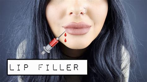 everything you need to know about lip filler my experience alexis luft youtube