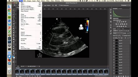 Tutorial Create Animated S From Ultrasound Clips Youtube