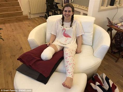 Woman Decided To Have Her Right Leg Amputated Daily Mail Online