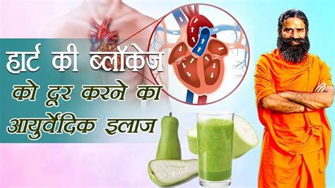 Ayurvedic Treatment For Heart Blockage Swami Ramdev Youtube