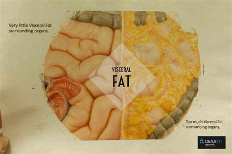 Know More About Belly Fat