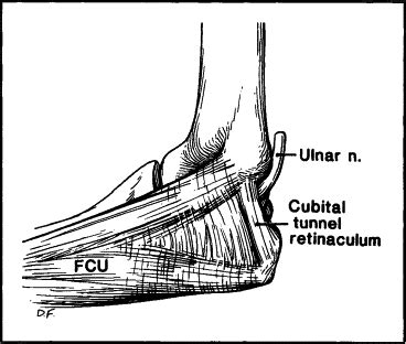 Perioperative Neuropathies Mayo Clinic Proceedings