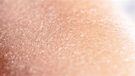 13 Causes Of Peeling Skin You Might Not Know