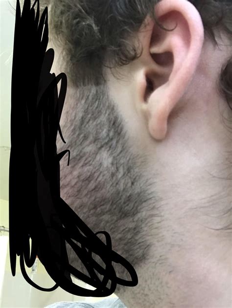 Accidentally Cut Side Hair While Trimming Sideburns Fierceflow