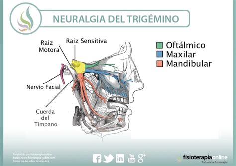 Neuralgia Del Trigémino Qué Es Causas Síntomas Tratamiento Y