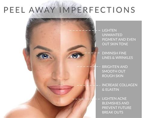 Chemical Peels Anaheim Hills Ca Huntington Beach Orange County