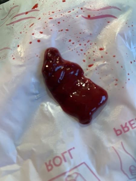 Warning Photo Is This A Miscarriage Or A Big Blood Clot Mumsnet