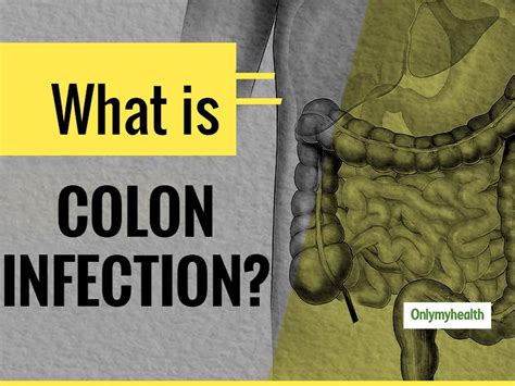 Colon Infection Meaning Causes And Symptoms