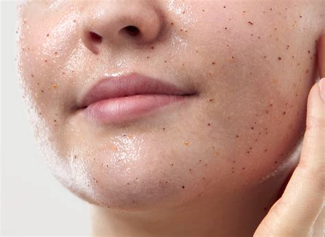 What Are The Benefits Of Exfoliating Your Face Laptrinhx News