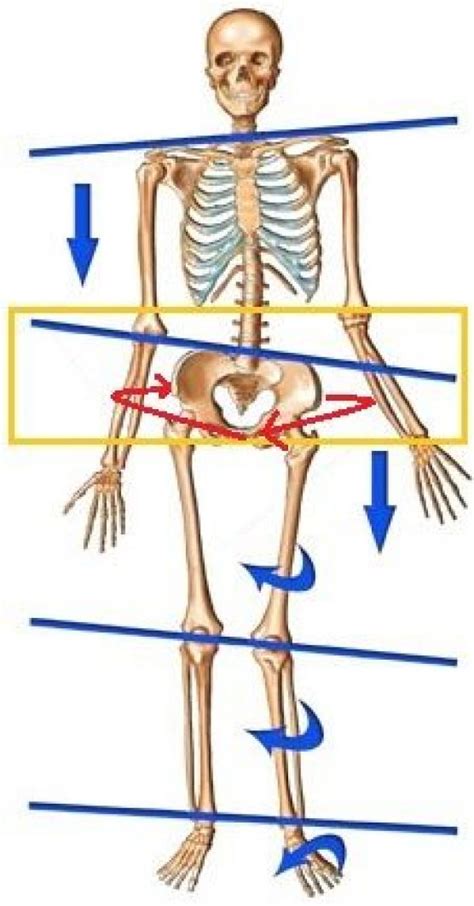 Do You Have A Twisted Or Rotated Pelvis Here Is A Comprehensive And