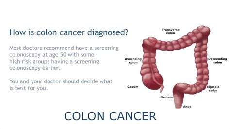 It is common in japan and china but is less common if the cancer spreads to other parts of the body, various other symptoms can develop. Most cancers Colon Simptome, Cancer colon transverse symptoms