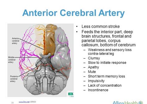 What Is The Difference Between A Cva And A Stroke