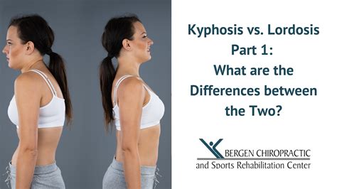Kyphosis Vs Lordosis Similarities And Differences