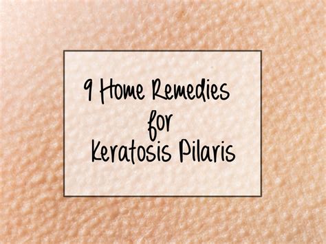 Top 9 Keratosis Pilaris Home Remedies Keratosis Pilaris Chicken Skin