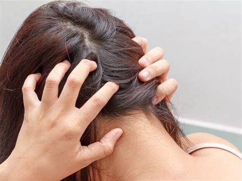 No More Scratching Home Remedies For Itchy Scalp