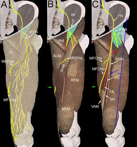 Lateral Femoral Cutaneous Nerve Entrapment Pictures