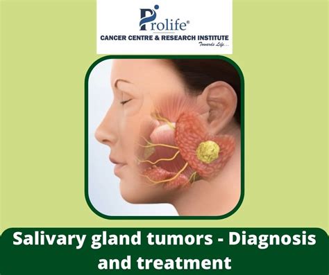 Salivary Gland Tumors Diagnosis And Treatment