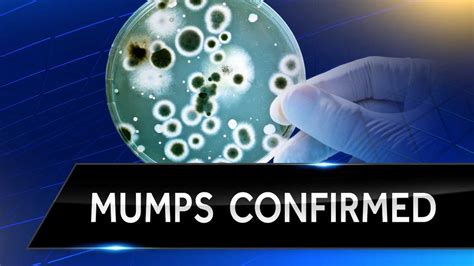 Health Officials Urge Vigilance As Uofl Mumps Case Confirmed