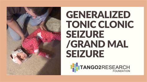 Generalized Tonic Clonic Seizure Grand Mal Seizure Youtube