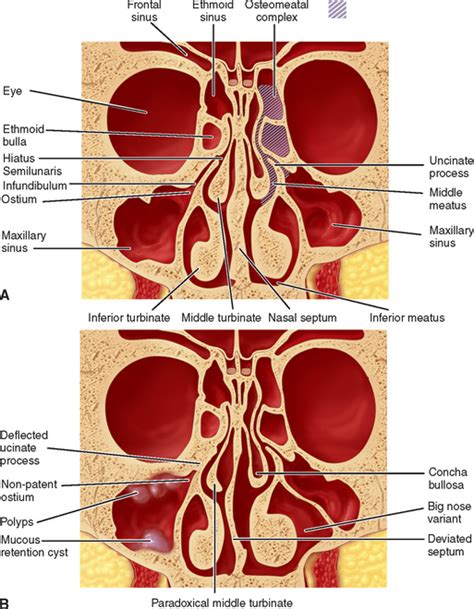 Maxillary Sinus Diagram