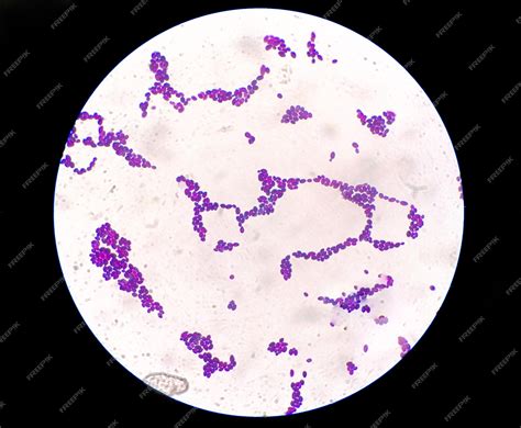 Premium Photo Candida Colony Under Microscopic View Or Candida