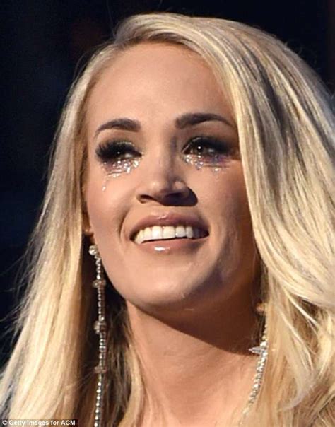 Carrie Underwood Reveals Scar On Lip As She Worries Disfigurement Would