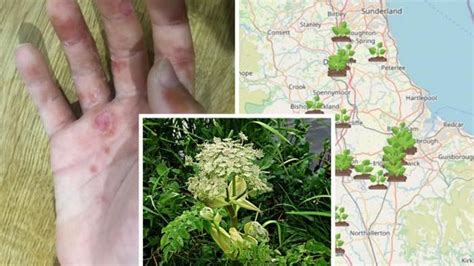 Map Shows Where Giant Hogweed Is Growing Across The North East By