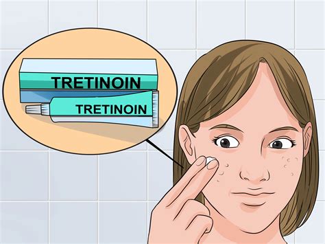 How to Use Tretinoin and Benzoyl Peroxide Concurrently