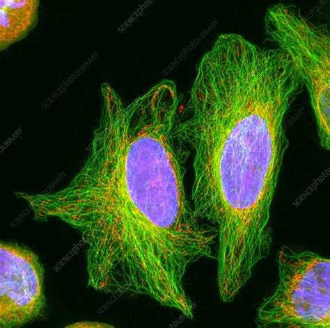 Hela Cells Light Micrograph Stock Image G4420257 Science Photo