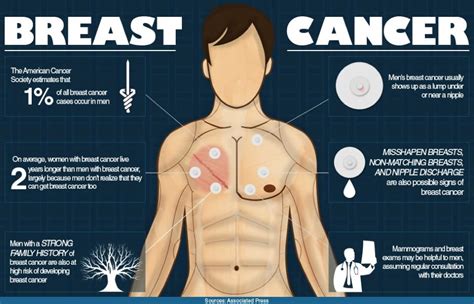 Male Breast Cancer Symptoms Causes Types And Diagnosis Cancerworld