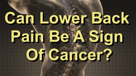 Can Lower Back Pain Be A Sign Of Cancer Youtube