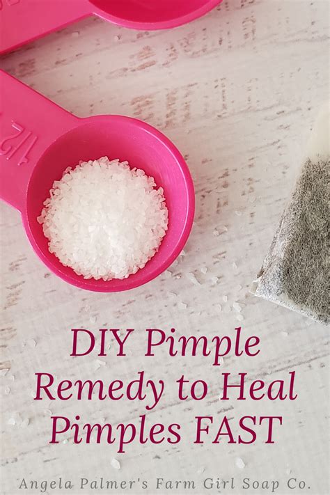 Diy Pimple Remedy To Heal Pimples Fast Pimples Remedies Pimples
