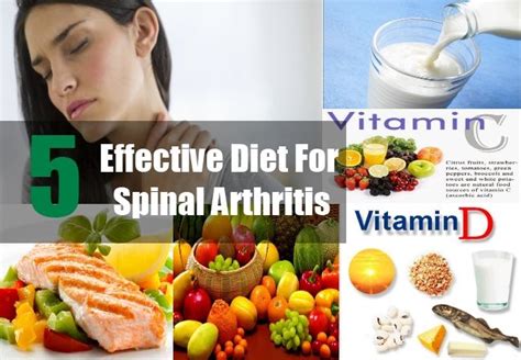 People with autoimmune conditions, such as rheumatoid arthritis (ra) and lupus, can experience hair loss as a troubling symptom of their disease. Foods That Cause Arthritis Inflammation >>> You can find ...