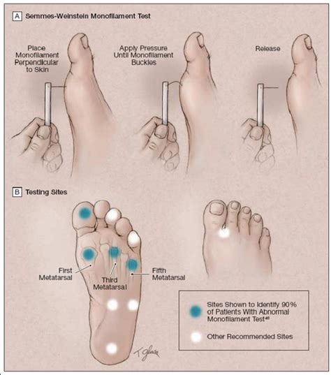 Diabetic foot ulcers can affect one's quality of life. Tangents: June 2012