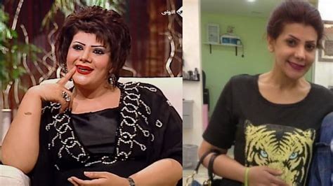 سالفة صورتي أمس وبعدين الصورة اللي حطيتوها. ‫لن تتخيل كيف تغير شكل الفنانة الهام الفضالة بعد عملية ...