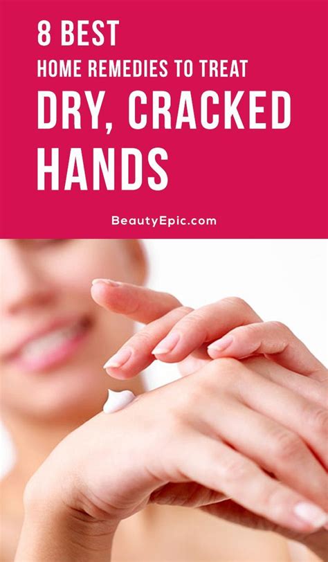 How To Heal Dry Cracked Hands Naturally At Home Dry Cracked Hands