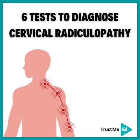 6 Tests To Diagnose Cervical Radiculopathy