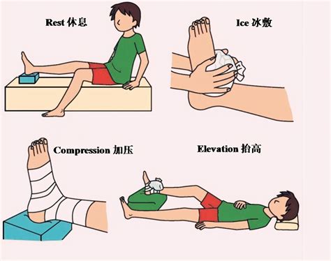 Rice Treatment Principles After Ankle Sprain Inews