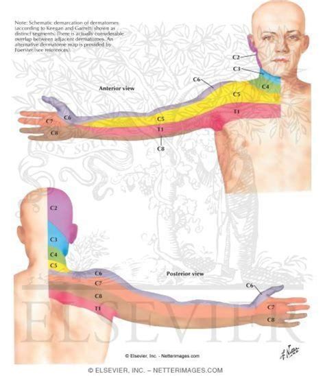 Dermatomes Of Upper Limb Patient Education Physical Therapy Dermatome Map