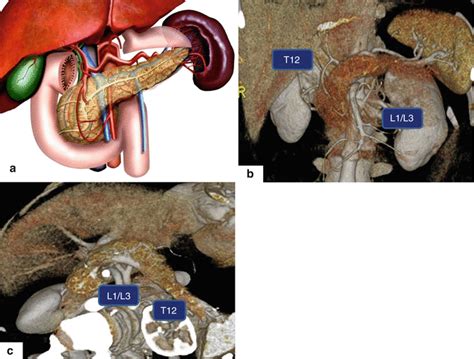 Anatomy Of The Pancreas Radiology Key