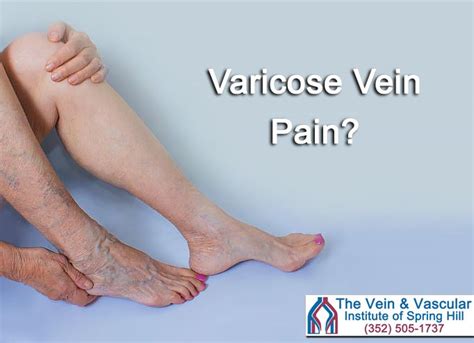 Varicose Veins Before And After Pictures Vein And Vascular Institute Artofit