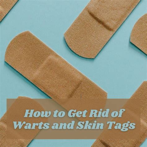 How To Remove Skin Tags And Warts On Your Body Naturally HubPages Diy
