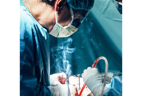 Key Surgical The Top 3 Dangers Of Surgical Smoke