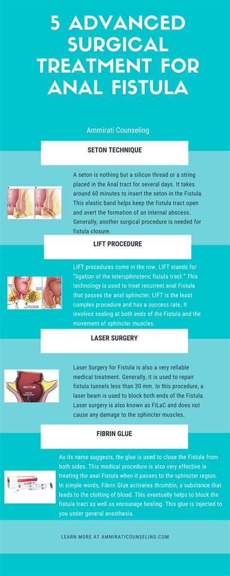 Advanced Surgical Treatment For Anal Fistula Social Social Social Social Social Social