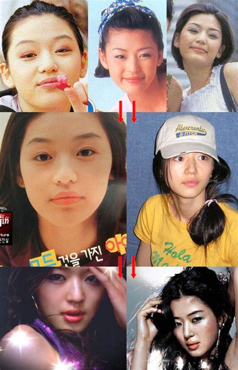 These are compilations of celebrities who went under the knife with the the following reasons 1) pressure of the agency or society 2). Korean actresses before and after plastic surgery - All ...