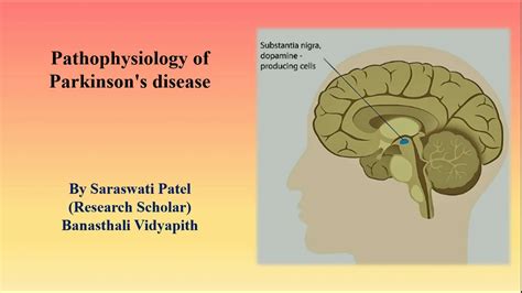 Dec 01, 2002 · abstract. Pathophysiology of Parkinsons disease - YouTube